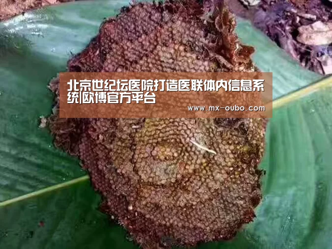北京世纪坛医院打造医联体内信息系统|欧博官方平台(图3) 欧博官方平台